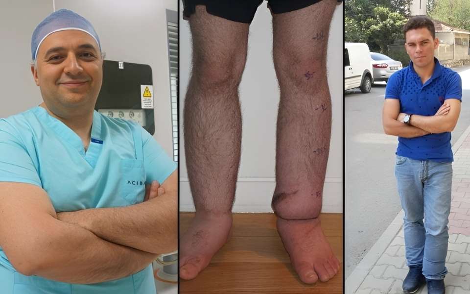 Turkish Professor Karaaltın Gave New Life to Yaşar, Who Fled ISIS